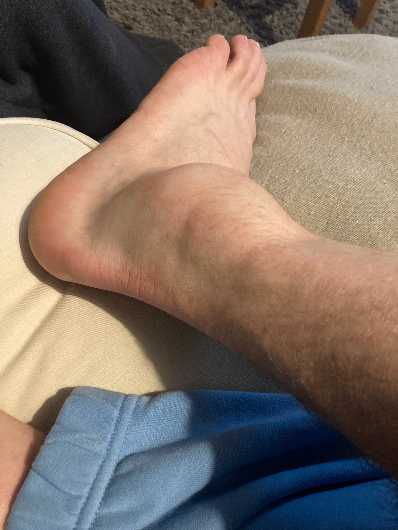 ankle.jpg