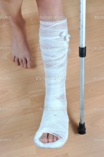 depositphotos_5227352-Broken-leg.jpg