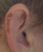 ear.JPG