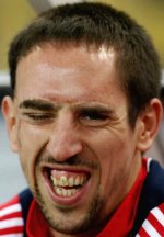 frank-ribery-face-teeth-ugly-uefa-ballon-dor-1.jpg